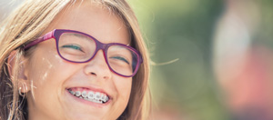 Cost of Braces in Bay Area Mountain View, CA Cost of Braces in Bay Area Mountain View, CA