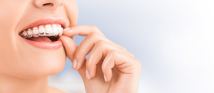 Straighter Teeth in Mountain View with Invisalign Straighter Teeth in Mountain View with Invisalign