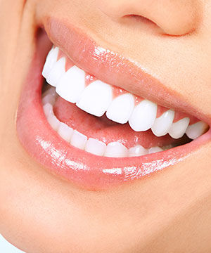 Smile Gallery at Allure Dental Center in Mountain View, CA