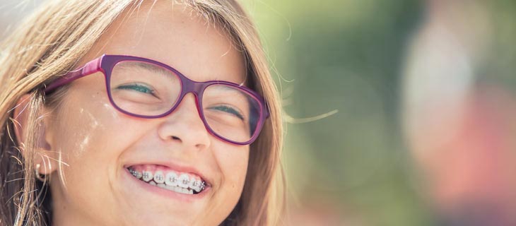 Cost of Braces in Bay Area Mountain View, CA Cost of Braces in Bay Area Mountain View, CA