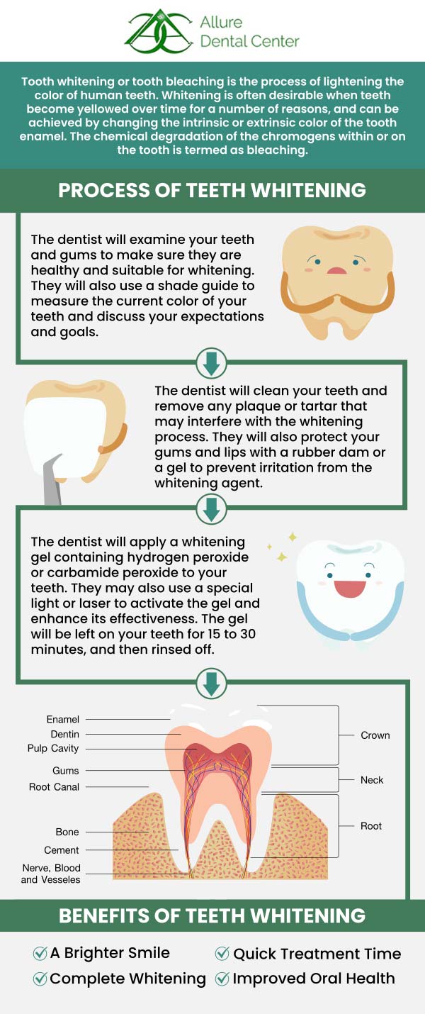 At Allure Dental Center, our dentists Dr. Trinh Lee and Dr. Suzanna Lee offer quality teeth whitening, including Zoom! In-office treatment, KöR Whitening, and custom whitening trays which are effective ways to impact your appearance and achieve the bright smile you want. For more information, contact us or schedule an online appointment. We are conveniently located at 570 N Shoreline Blvd Mountain View, CA 94043. At Allure Dental Center, our dentists Dr. Trinh Lee and Dr. Suzanna Lee offer quality teeth whitening, including Zoom! In-office treatment, KöR Whitening, and custom whitening trays which are effective ways to impact your appearance and achieve the bright smile you want. For more information, contact us or schedule an online appointment. We are conveniently located at 570 N Shoreline Blvd Mountain View, CA 94043.