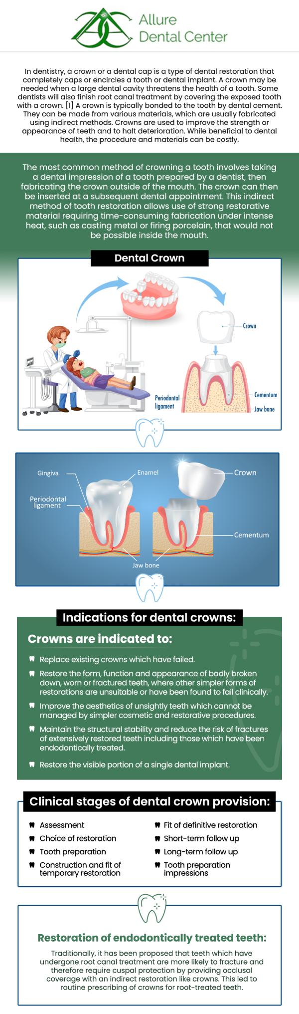 A dental crown is a tooth-shaped cap that restores a decayed, broken, weak, or worn-down tooth. Our board-certified Dr. Trinh Lee and Dr. Suzanna Lee provide comprehensive and specialized diagnosis and treatment. Visit Allure Dental Center to learn more. For more information, contact us or schedule an online appointment. We are conveniently located at 570 N Shoreline Blvd Mountain View, CA 94043. A dental crown is a tooth-shaped cap that restores a decayed, broken, weak, or worn-down tooth. Our board-certified Dr. Trinh Lee and Dr. Suzanna Lee provide comprehensive and specialized diagnosis and treatment. Visit Allure Dental Center to learn more. For more information, contact us or schedule an online appointment. We are conveniently located at 570 N Shoreline Blvd Mountain View, CA 94043.