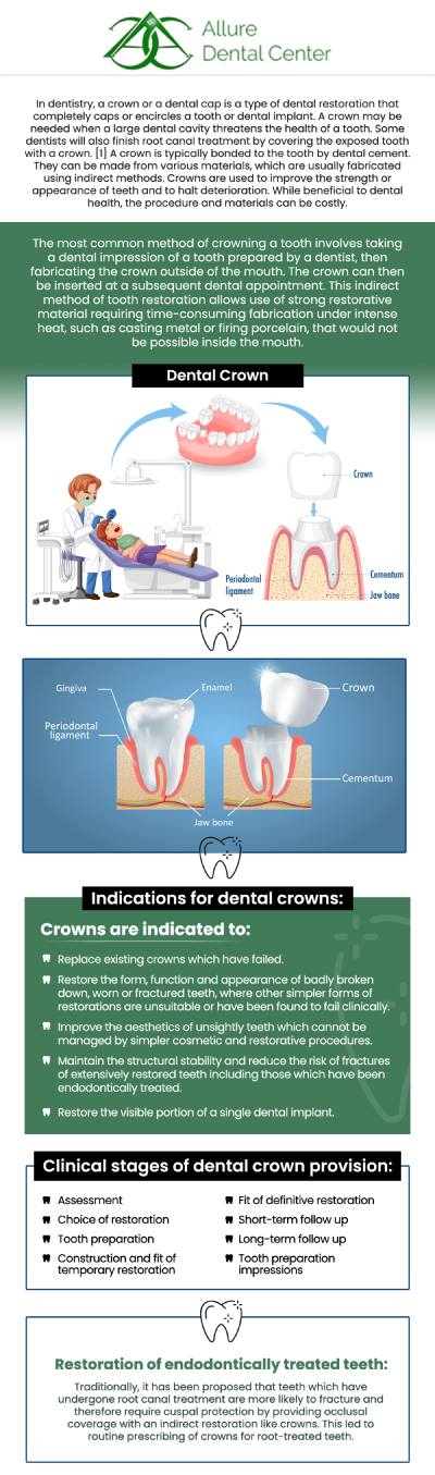 Dental crowns are used to cure severely damaged teeth, while filings are used to address minor tooth decay and damage. If you are not sure about getting crowns and fillings, talk to our dentists, Dr. Trinh Lee and Dr. Suzanna Lee at Allure Dental Center. For more information, contact us or schedule an online appointment. We serve patients from Mountain View CA, and surrounding Bay Area cities. Dental crowns are used to cure severely damaged teeth, while filings are used to address minor tooth decay and damage. If you are not sure about getting crowns and fillings, talk to our dentists, Dr. Trinh Lee and Dr. Suzanna Lee at Allure Dental Center. For more information, contact us or schedule an online appointment. We serve patients from Mountain View CA, and surrounding Bay Area cities.