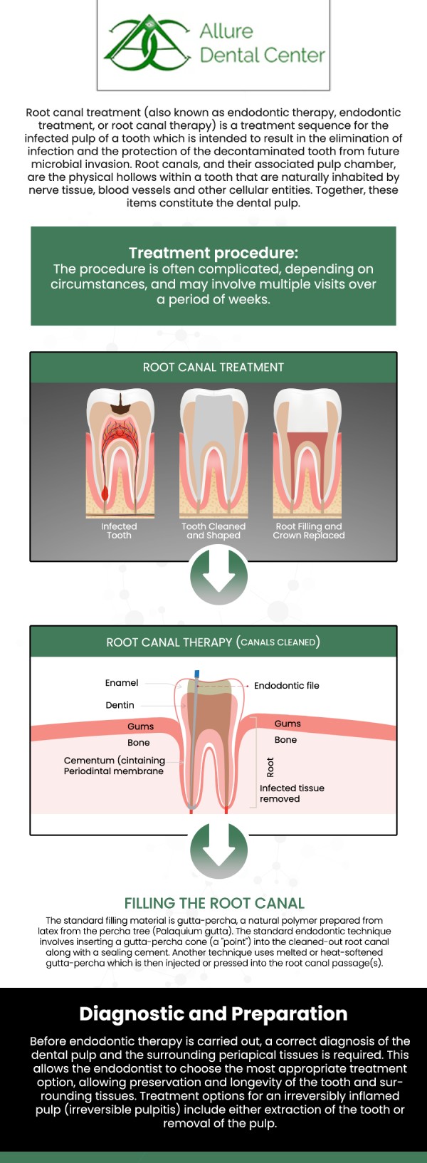 Root canal treatment is used to remove bacteria from an infected root canal, prevent infection from returning, and save the natural tooth. It may help in the preservation of tooth function, allowing patients to chew properly with normal bite power. The signs and symptoms indicate that you require a root canal: persistent tooth pain, tooth sensitivity, tooth discoloration, broken teeth, swollen gums, and extensive decay. If you have a tooth that is infected, root canal treatment may be able to save it. Our dentists Dr. Trinh Lee and Dr. Suzanna Lee at Allure Dental Center offer root canal treatment. For more information, contact us or schedule an online appointment. We are conveniently located at 570 N Shoreline Blvd Mountain View, CA 94043. Root canal treatment is used to remove bacteria from an infected root canal, prevent infection from returning, and save the natural tooth. It may help in the preservation of tooth function, allowing patients to chew properly with normal bite power. The signs and symptoms indicate that you require a root canal: persistent tooth pain, tooth sensitivity, tooth discoloration, broken teeth, swollen gums, and extensive decay. If you have a tooth that is infected, root canal treatment may be able to save it. Our dentists Dr. Trinh Lee and Dr. Suzanna Lee at Allure Dental Center offer root canal treatment. For more information, contact us or schedule an online appointment. We are conveniently located at 570 N Shoreline Blvd Mountain View, CA 94043.